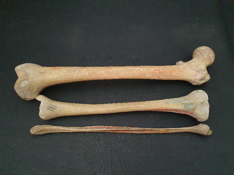Antique real human medically prepared leg bones.