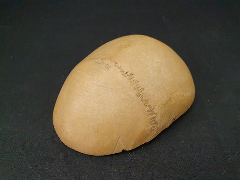 Real human cranium / calvarium medical specimen.