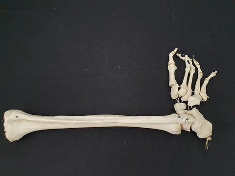Real human tibia, fibula and articulated foot bones