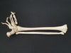 Real human lower leg bones