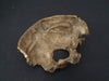 Victorian medical museum real human bones. Cranium showing advanced hyperostosis frontalis interna.