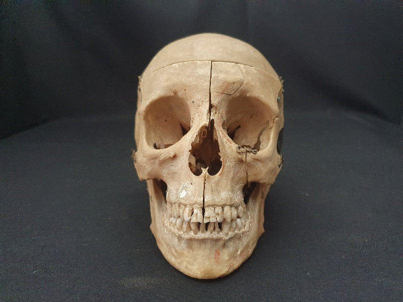 Adam Rouilly real human demonstration skull for sale