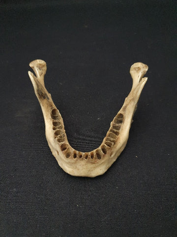 Real human jawbone medical specimen.
