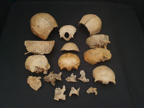 Medical school collection of antique disarticulated skull pieces.