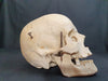 Real human medical skull for sale