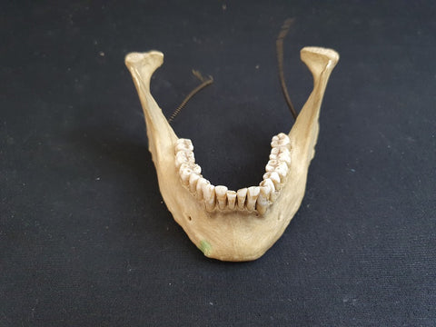 Antique real human jawbone / mandible medical specimen complete dentition.
