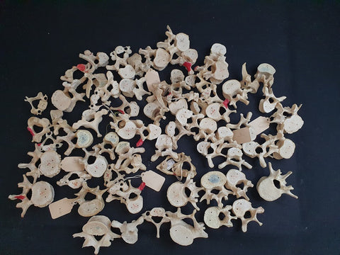 Medical school collection of 71 assorted real human vertebrae