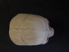 Real human medical skull showing persistent metopic suture