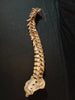 Antique, medically prepared vertebral column / spine and sacrum