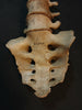 Antique, medically prepared vertebral column / spine and sacrum