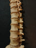Antique, medically prepared vertebral column / spine and sacrum