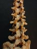 Antique, medically prepared vertebral column / spine and sacrum