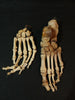 Antique articulated real human medical foot and hand.