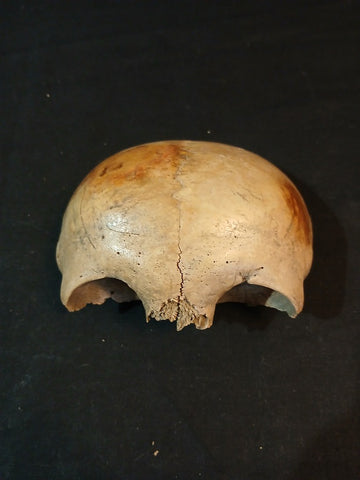 Antique real human frontal bone showing persistent suture.