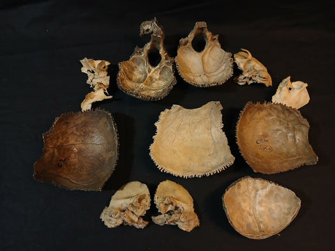 Collection of antique medically prepared human disarticulated skull bones