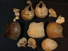 Collection of antique medically prepared human disarticulated skull bones