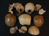 Collection of antique medically prepared human disarticulated skull bones