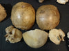 Collection of antique medically prepared human disarticulated skull bones