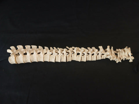Medically prepared real human vertebral column