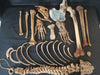  real human medical half skeleton without skull for sale