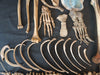  real human medical half skeleton without skull for sale