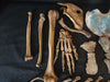  real human medical half skeleton without skull for sale