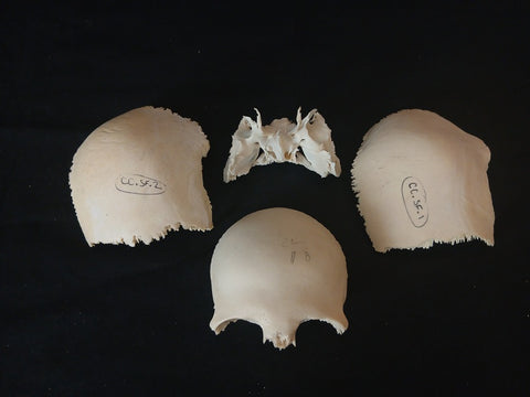 Medically prepared human disarticulated skull bones