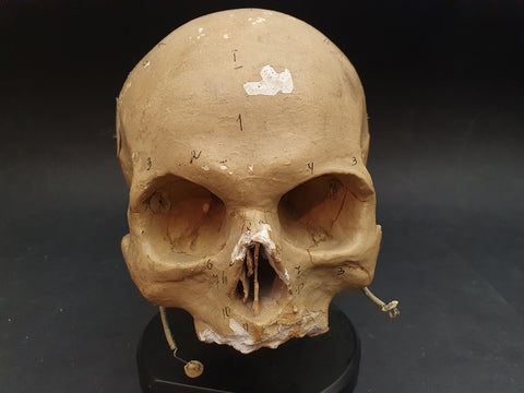 Vintage Russian model life-size human skull teaching aid.