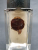 Victorian medical wet specimen preserved half human eye