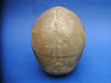 Antique Adam Rouilly medical real human half skeleton in wooden box for sale