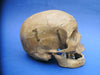 Antique Adam Rouilly medical real human half skeleton in wooden box for sale