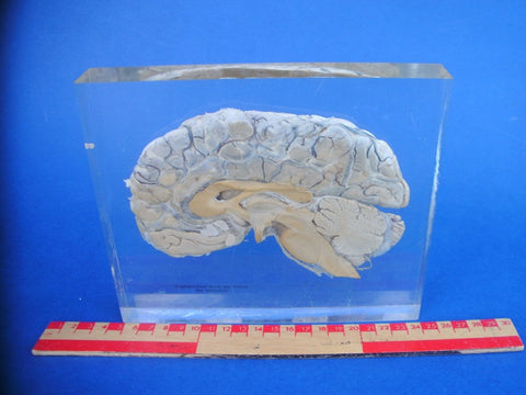 Sagittal section of a real human brain encased in resin Medical exhibit.