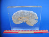 Sagittal section of a real human brain encased in resin Medical exhibit.