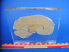 Sagittal section of a real human brain encased in resin Medical exhibit.